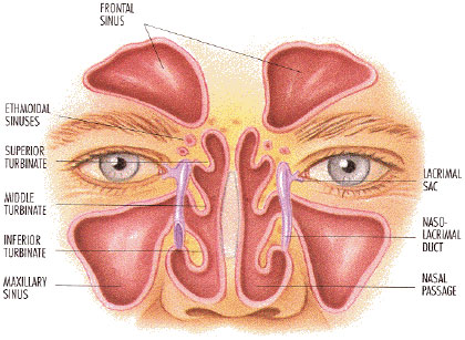  chance of Nasal Polyps.